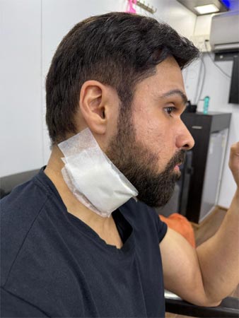 Emraan injured on the sets of 'Gudhachari 2'