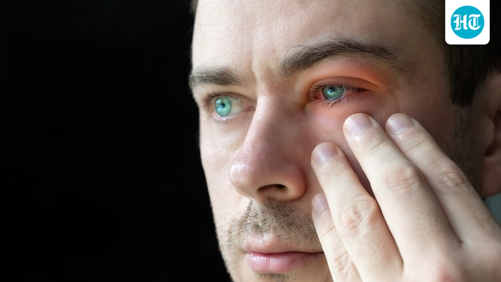 conjunctivitis_1752929976485_1786348326152_a3cf3e14-bd77-41fe-a559-5586dca911aa.jpg